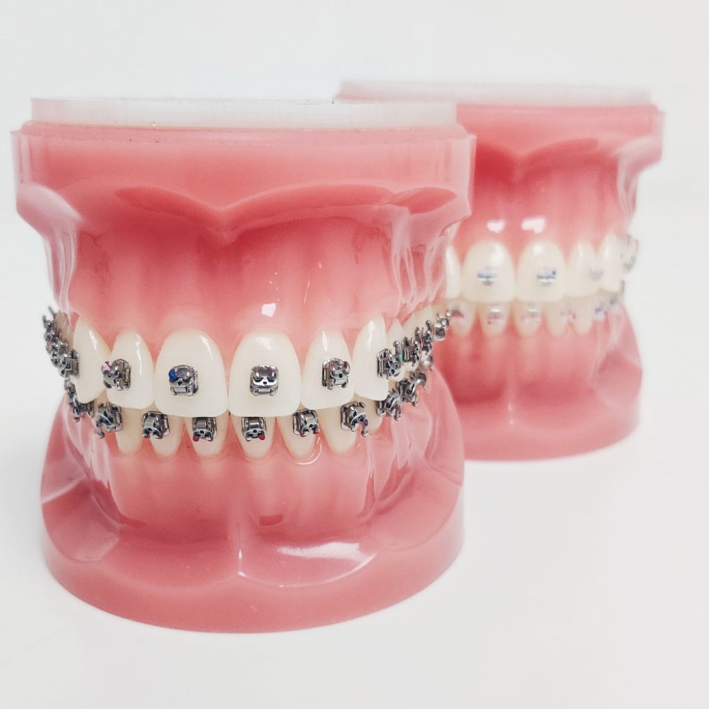 paneel In de naam repertoire Orthodontie Amstelveen | Persoonlijk behandelplan | Voor jong en oud!